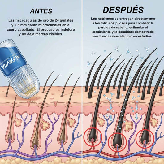Alfavita™ Sistema Regeneración Capilar