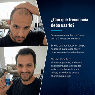 Alfavita™ Sistema Regeneración Capilar (4 meses)