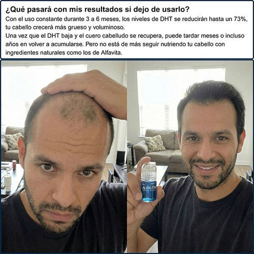 Kit Definitivo Para Crecimiento Capilar